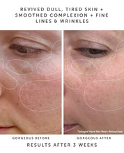 Load image into Gallery viewer, Anchor Bio-Retinol Youth Serum
